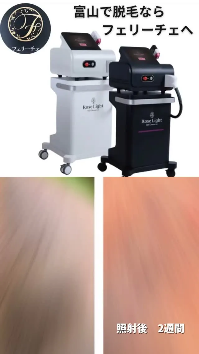 6歳から可能なフェリーチェの脱毛👍✨