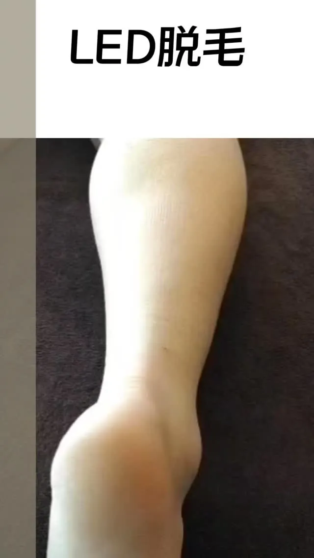 ＼どうせエステ脱毛なんて？言わせません‼️／